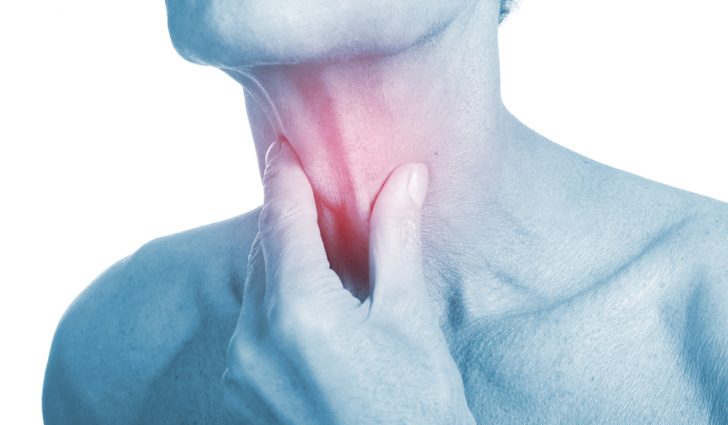 Злокачественная опухоль на горле